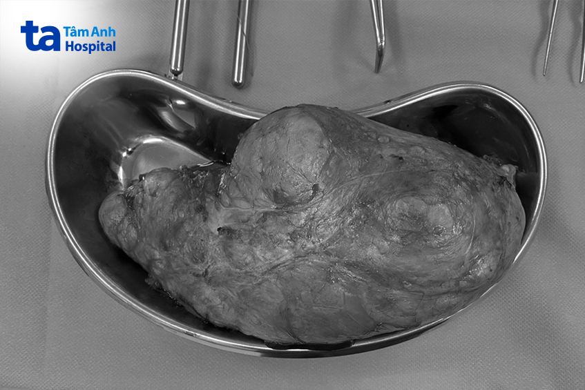 thận của bệnh nhân