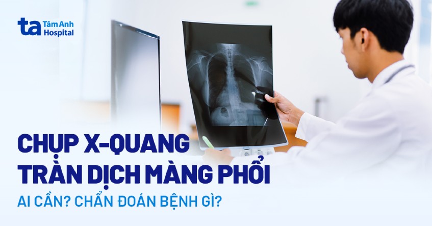 tràn dịch màng phổi x quang