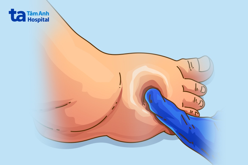 trẻ cần tuân thủ nghiêm ngặt quy định của bác sĩ