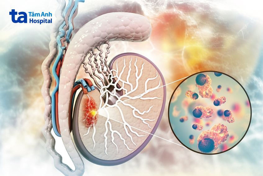 U minatkadan g‘o‘qirdi