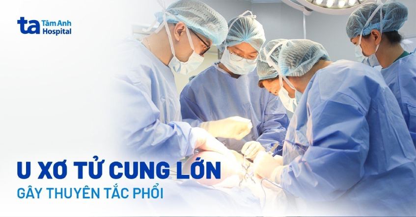 Khối u nặng 2,3 kg trong tử cung người phụ nữ