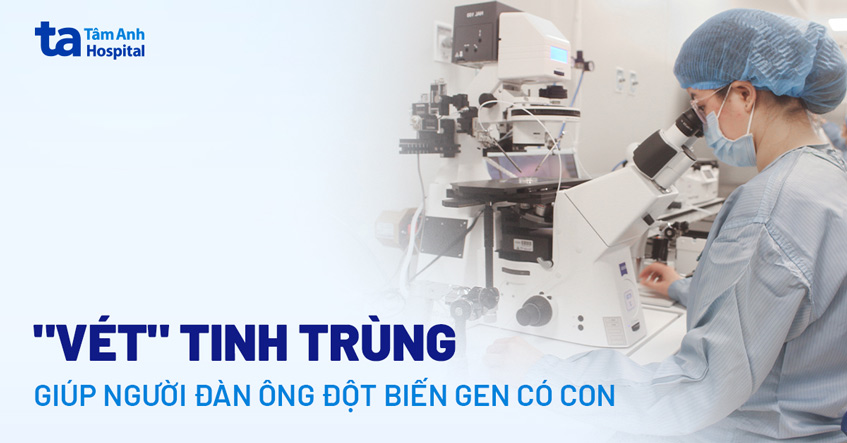 “Vét” tinh trùng cho người đàn ông đột biến gene AZF