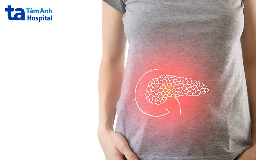 viêm tụy hoại tử là gì