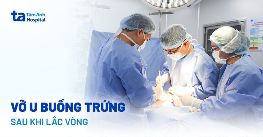 Vỡ u buồng trứng to như thai 9 tháng sau khi lắc vòng