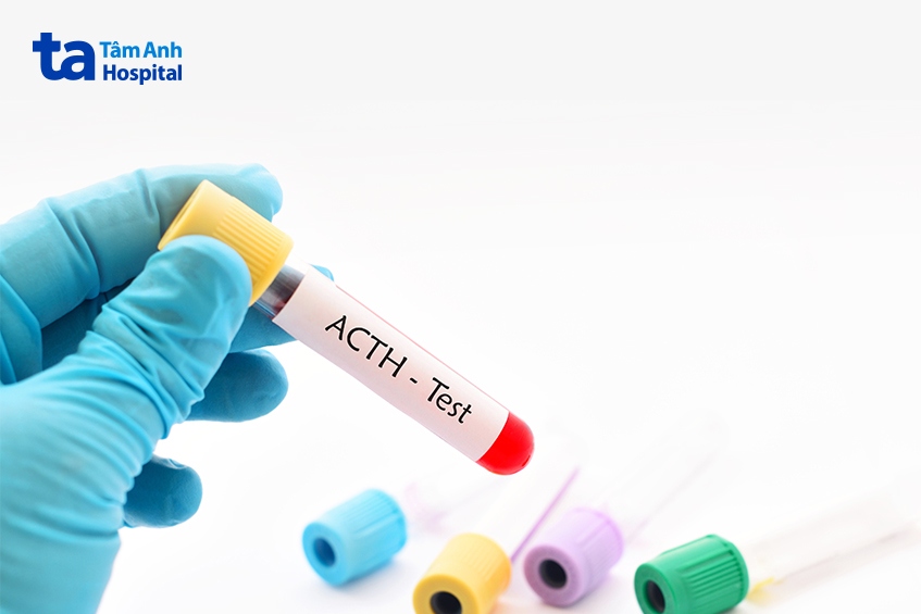 Xét nghiệm ACTH để chẩn đoán hội chứng Cushing ở trẻ em