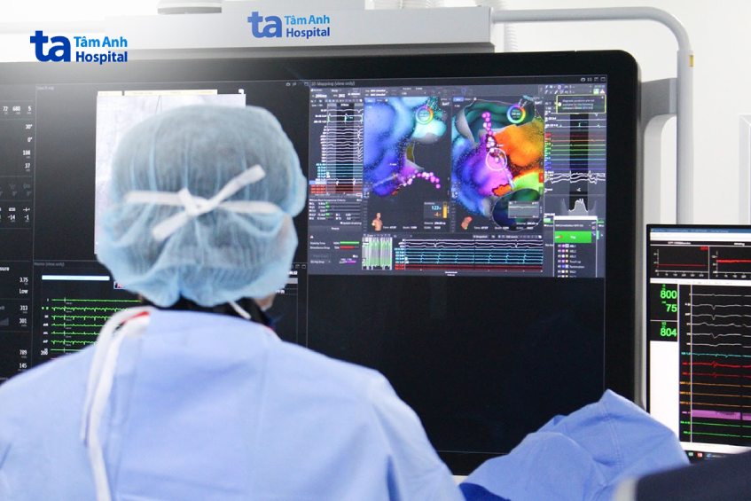 Bác sĩ Bệnh viện Tâm Anh triệt đốt rung nhĩ bằng sóng cao tần với sự hỗ trợ của bản đồ điện học 3D