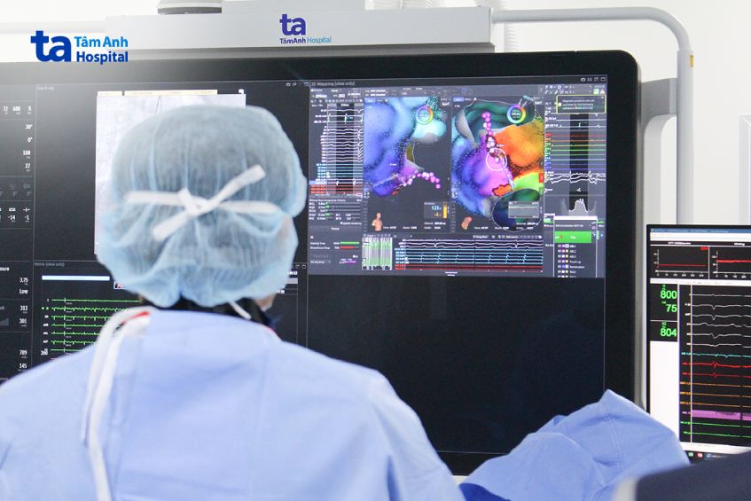 Bác sĩ khoa Loạn nhịp - Điện sinh lý tiến hành triệt đốt rung nhĩ với sự hỗ trợ của bản đồ điện học 3D bằng catheter 64 điện cực