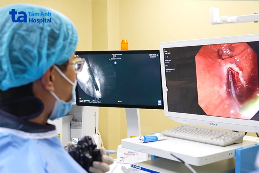 bác sĩ kiểm tra cắt u