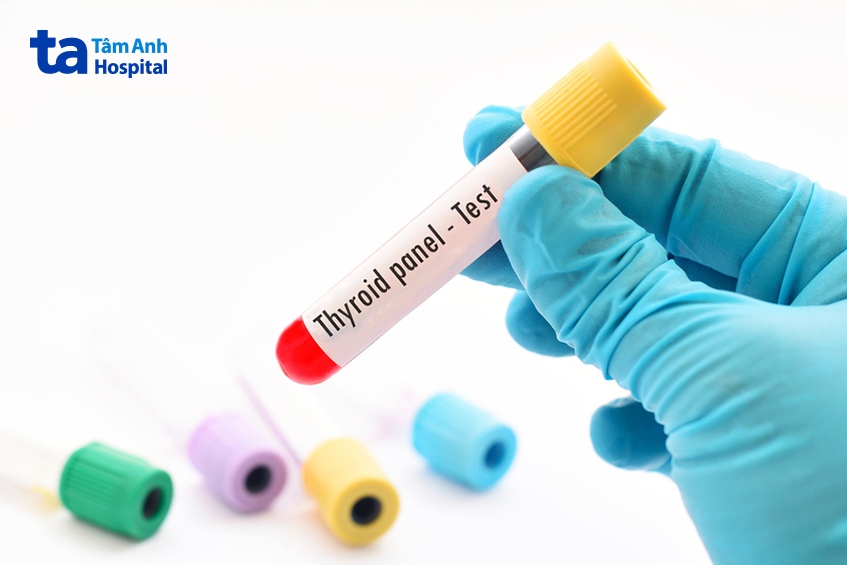 Bác sĩ sẽ chỉ định xét nghiệm máu