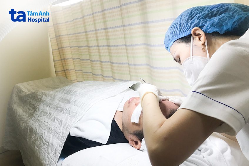 Bác sĩ thực hiện tiểu phẫu