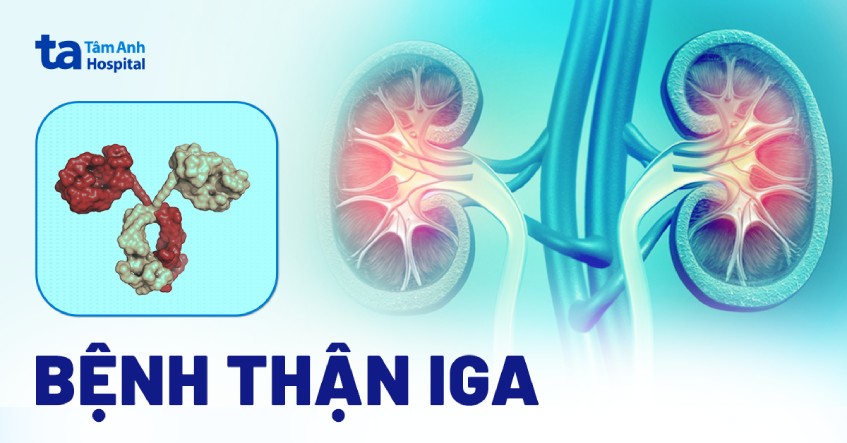 bệnh thận iga