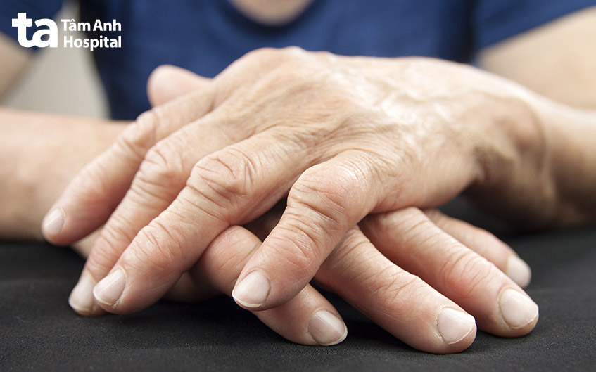 bệnh viêm khớp dạng thấp