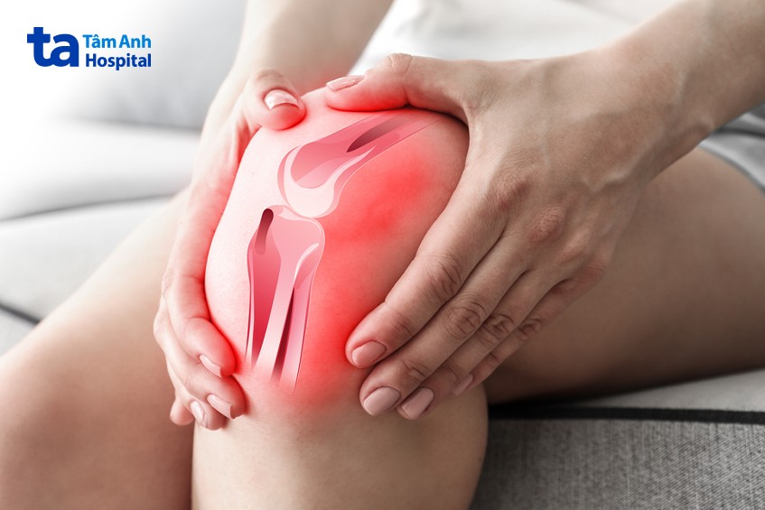 Béo phì độ 2 dễ gây viêm xương khớp