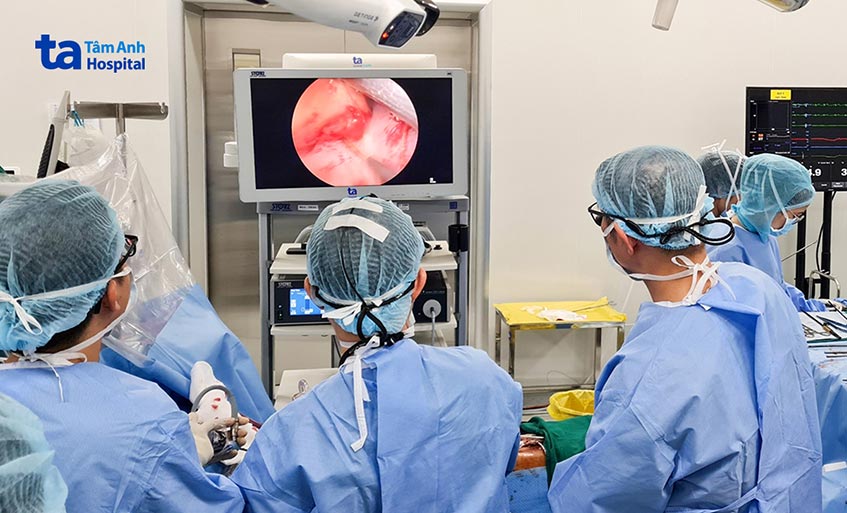 Các bác sĩ phẫu thuật nội soi lấy khối u nhú trên van tim hiếm gặp cho bệnh nhân