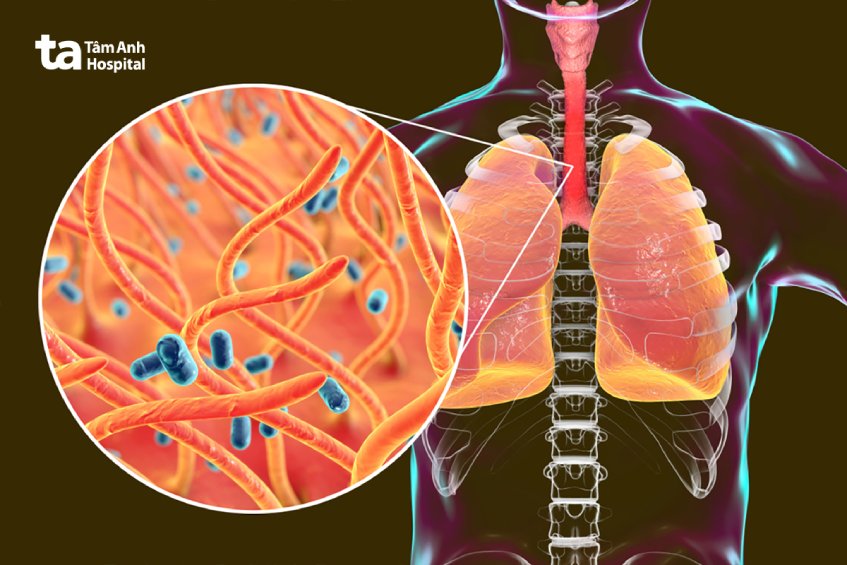 Các bệnh lý về đường hô hấp, suy hô hấp