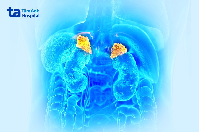 Cách điều trị hội chứng Cushing hiệu quả, an toàn