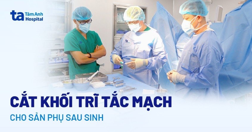cắt trĩ tắc mạch cho sản phụ