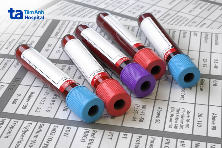 chẩn đoán bệnh thận iga