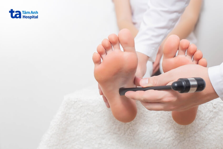 chẩn đoán viêm đa thần kinh