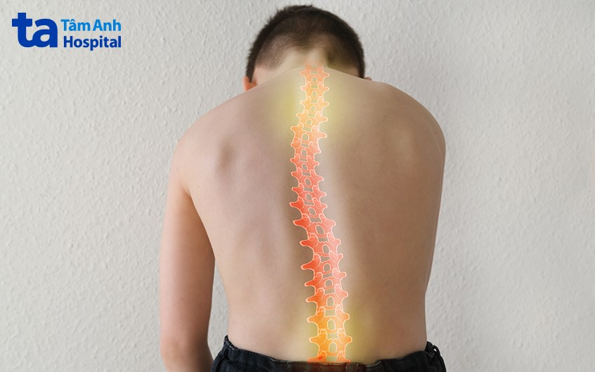 chụp x quang lưng có phải cởi quần áo không