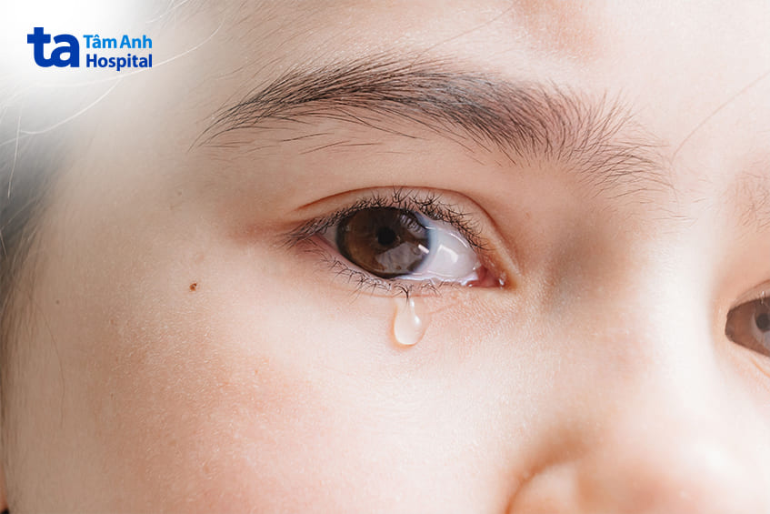 Dấu hiệu đau mí mắt