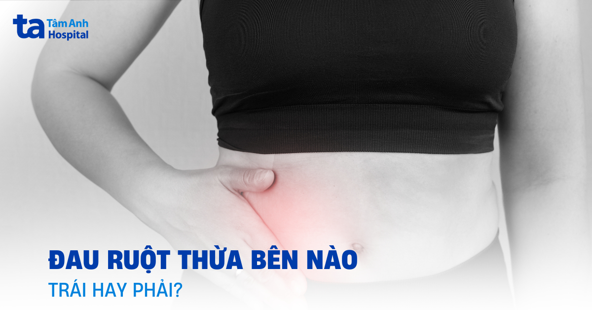 Đau ruột thừa bên nào? Đau bên trái hay bên phải?