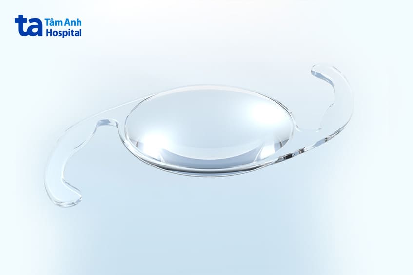 điều trị bệnh cườm mắt