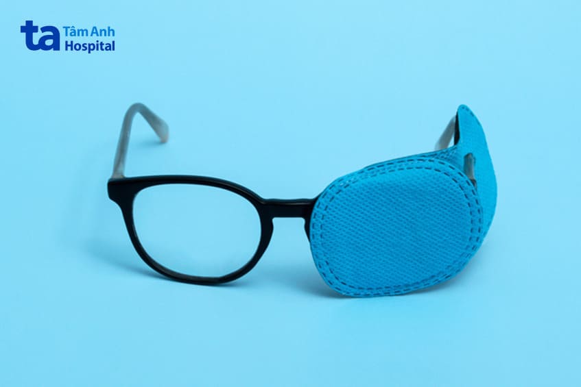 điều trị nhược thị