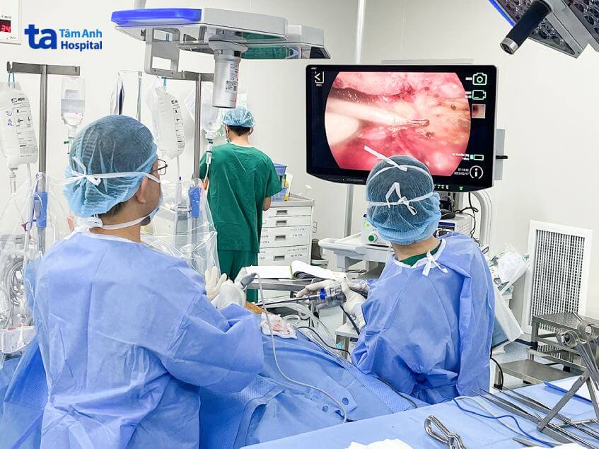 điều trị ung thư phổi giai đoạn đầu