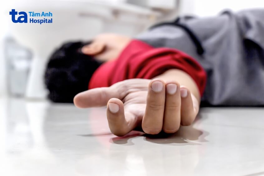 đột quỵ cần can thiệp mạch máu não