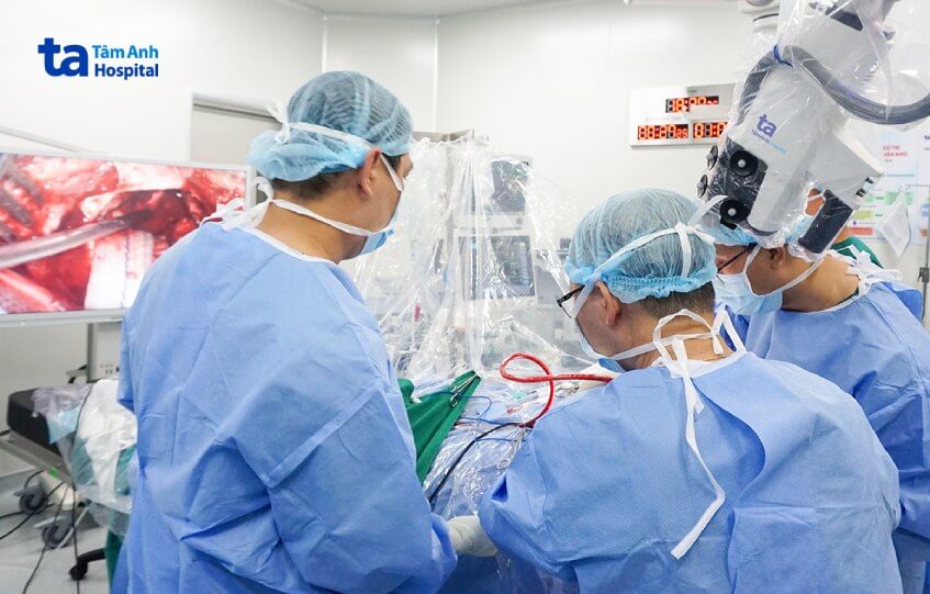 Ê kíp phẫu thuật lấy khối xuất huyết trong não cho bệnh nhân