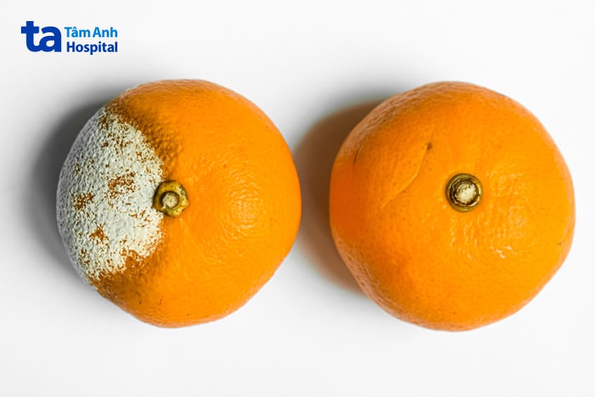 hoại tử da vú sau phẫu thuật