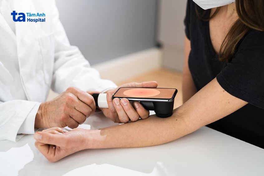 khám tiên lượng thời gian sống ung thư da