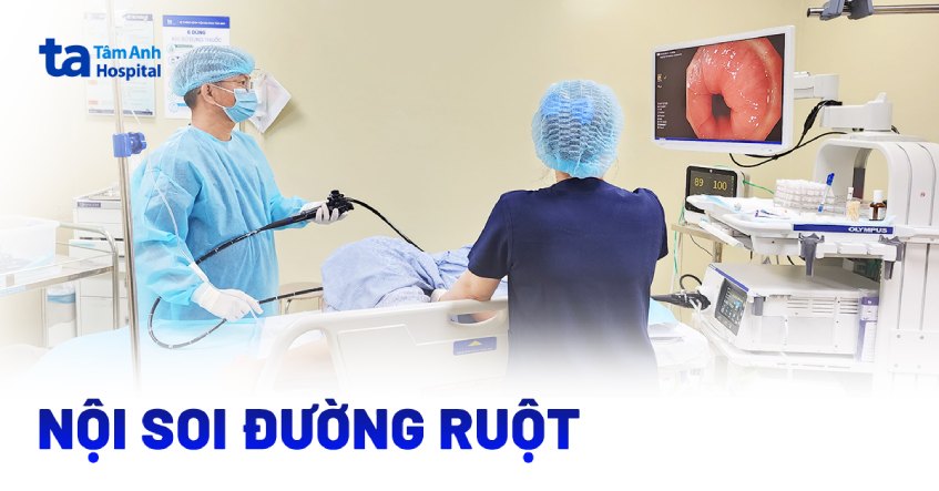 khi nào cần nội soi đường ruột