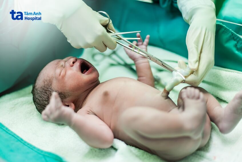 lưu trữ máu cuống rốn ở đâu