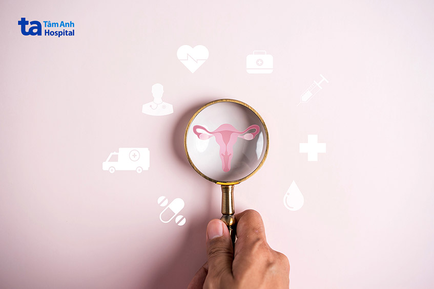 những lưu ý trước khi thực hiện