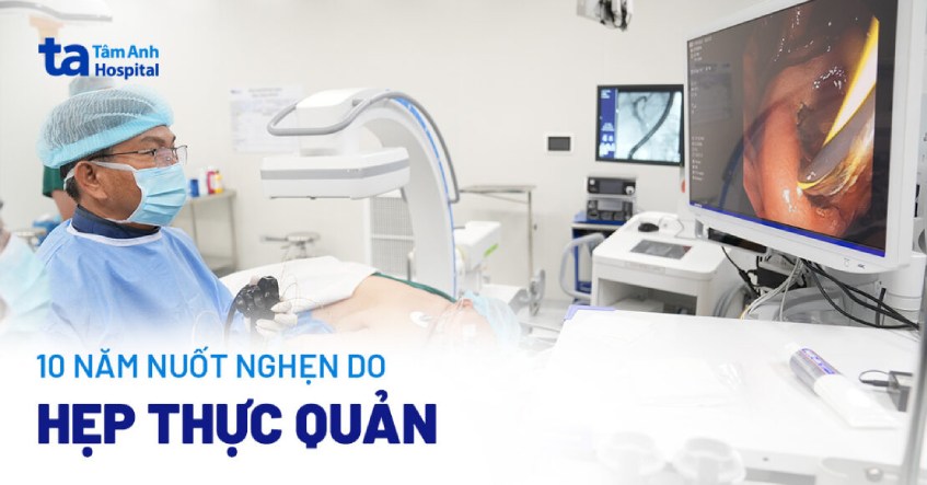 nuốt nghẹn hẹp thực quản
