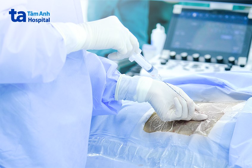Qua chỉ dẫn của màn hình máy siêu âm, PGS Đỗ Trường Thành nhanh chóng tiếng cận được vị trí thận tổn thương. 