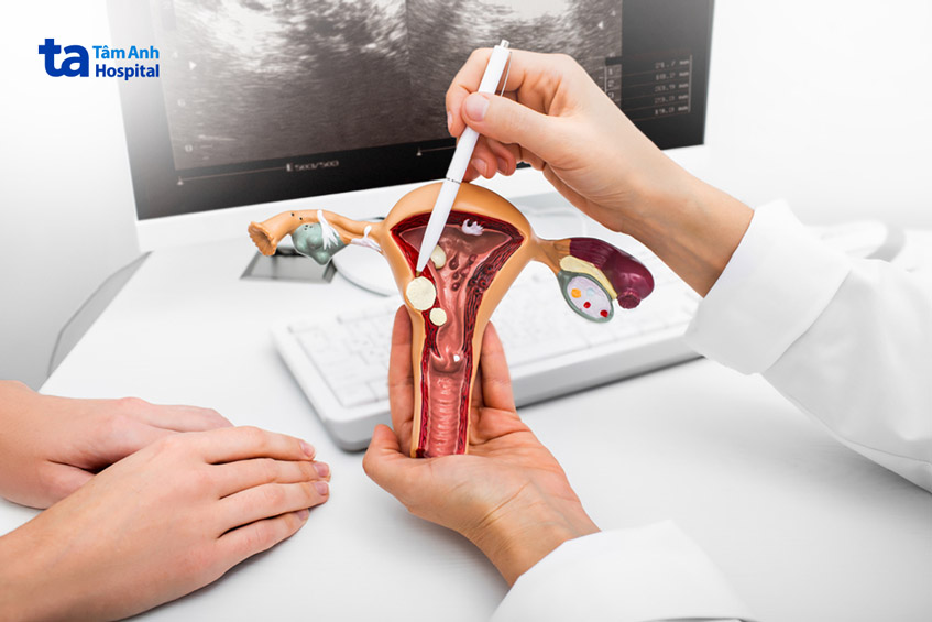 phác đồ điều trị polyp