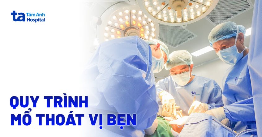 phẫu thuật thoát vị bẹn