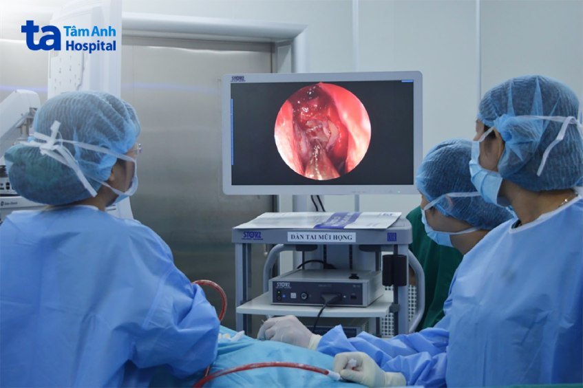 phẫu thuật viêm xoang sàng