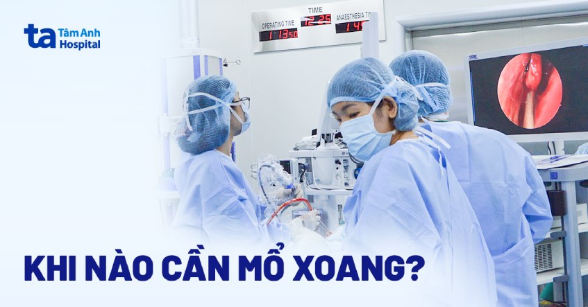 phẫu thuật xoang