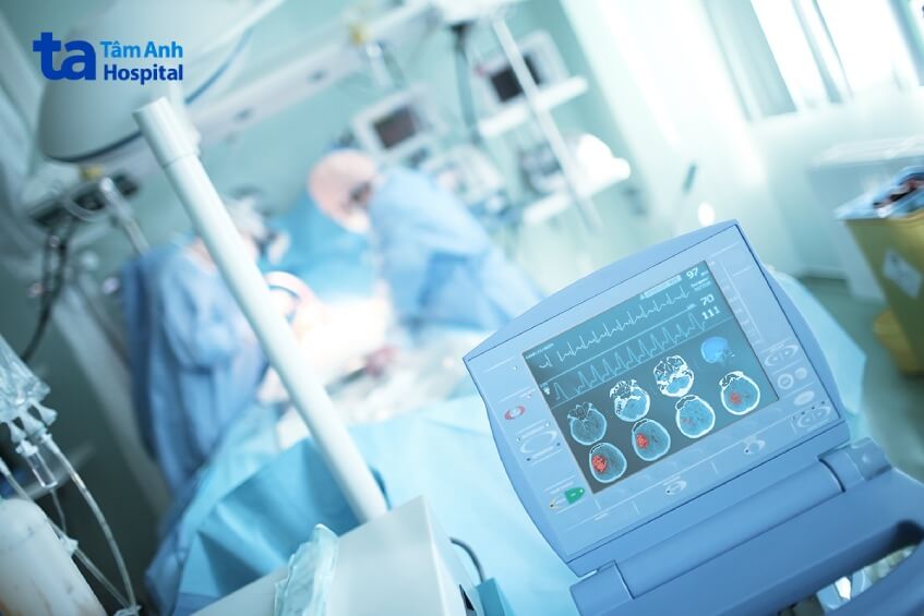 phương pháp can thiệp mạch máu não