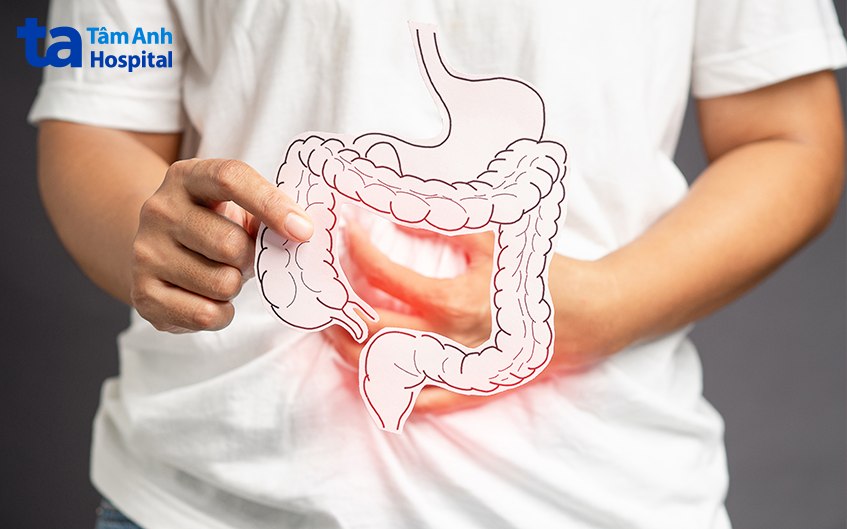 phương pháp nội soi đường ruột