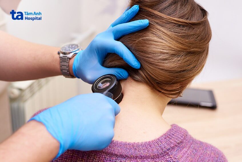 phương pháp tầm soát ung thư da