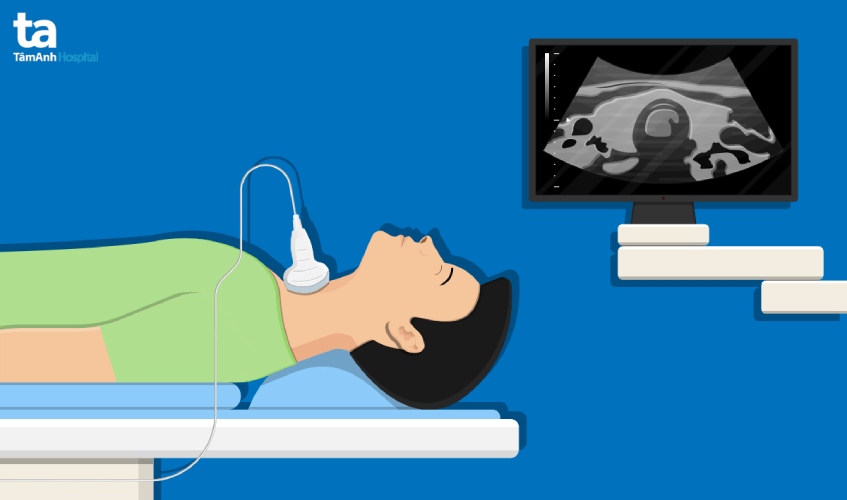 RFA là phương pháp sử dụng nhiệt để hủy khối u