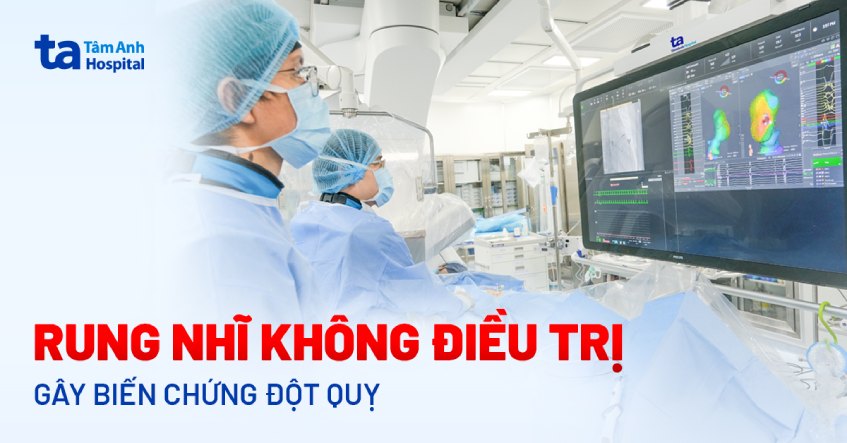 Cảnh báo nguy cơ đột quỵ do biến chứng bệnh rung nhĩ