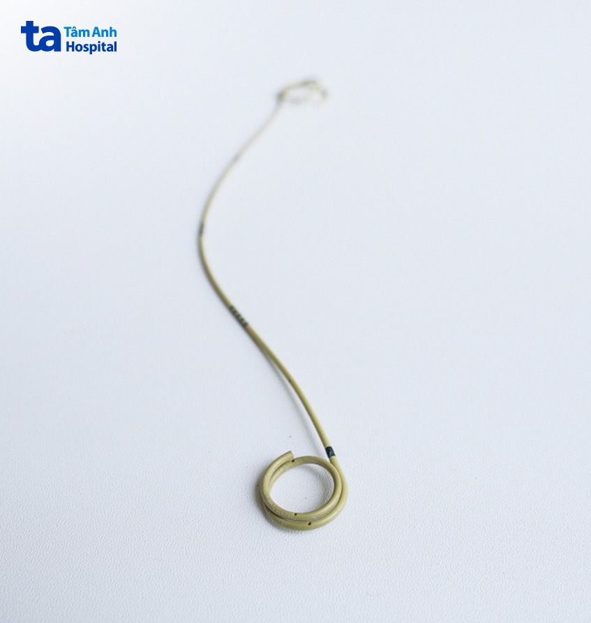 tác dụng của ống thông jj niệu quản
