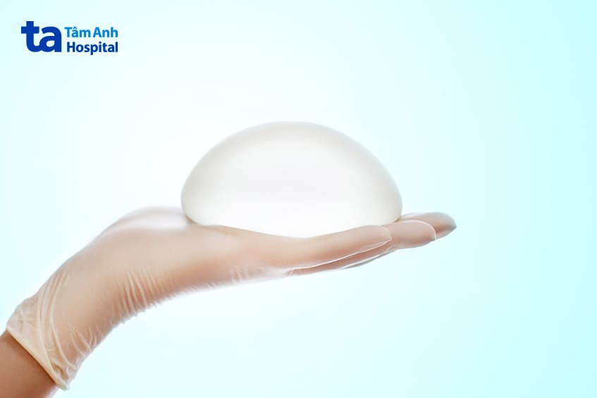 tái tạo vú cấy ghép giãn mô
