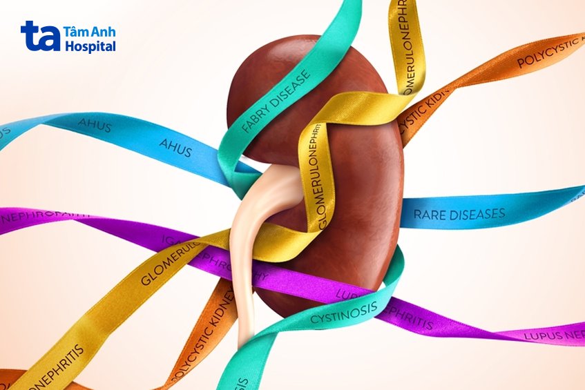 triệu chứng bệnh thận iga